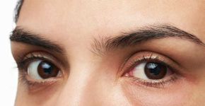 11 dicas para se livrar das olheiras