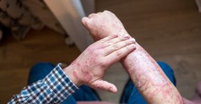 Foto: (iStock/200mm)