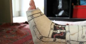 Tornozelo quebrado ou mau humor: conheça as 10 desculpas mais esfarrapadas para faltar no trabalho