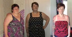 Ex-obesa desiste de cirurgia e perde mais de 70 Kg com alimentação saudável e exercícios