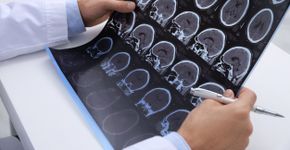 Foto: (iStock/Liudmila Chernetska)