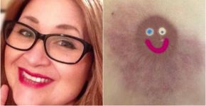 Mulher com câncer de mama critica Facebook por ter excluído foto de seio