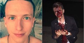 Apoiadores de Trump atacam jovem gay na Califórnia
