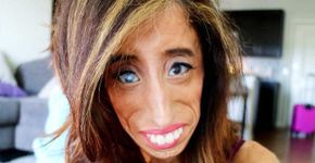 Mulher com doença rara conta o que é beleza para ela