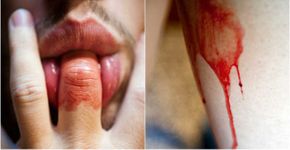 Estas fotos querem romper o tabu relacionado à menstruação