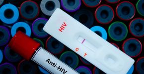 Foto: (HIV/iStock)