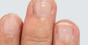 Foto: (iStock/Toa55)
