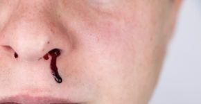 Foto: (Alona Siniehina/istock)