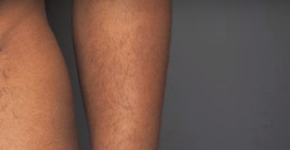 Fotos de homens e trans nus somem de exposição que foi suspensa