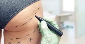 Foto: (ronstik/istock)