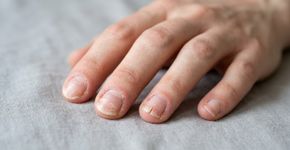 O hábito doméstico que enfraquece suas unhas acontece justamente enquanto você está cuidando da casa