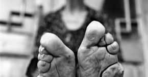 Pés de lótus: fotógrafa registra a dolorosa tradição chinesa