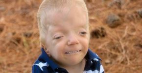 Mãe de menino com doença terminal luta contra memes com seu filho
