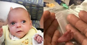 Ariana, que nasceu com 350g, recebe alta após 5 meses de hospital