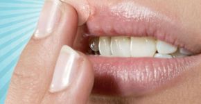 Especialistas esclarecem dúvidas sobre a herpes simples