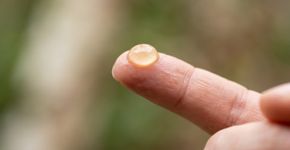 Passar óleo de rícino sob os olhos à noite pode hidratar a pele, mas não há evidência sólida de que elimine as olheiras