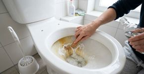 Como restaurar a brancura do vaso sanitário: dicas simples e práticas para remover manchas difíceis