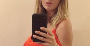 Entenda a doença que faz ex-modelo parecer estar grávida
