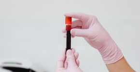 Exame de sangue detecta câncer antes mesmo dos sintomas