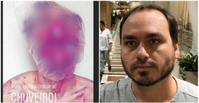 Post sanguinolento de Carlos Bolsonaro é acusado de homofobia