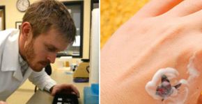 Canadense cria creme capaz de remover tatuagem sem dor