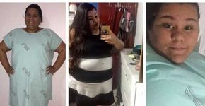 Garota de 19 anos tem complicações após cirurgia bariátrica