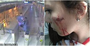 Vídeo mostra jovem sendo esfaqueada por ladrão em estação no RJ