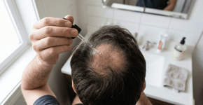 Queda de cabelo: aqui estão os melhores tratamentos para engrossar os fios