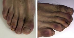 Foto: (Jornal da Academia Americana de Dermatologia PA)