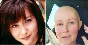 Atriz compartilha rotina na internet após ter câncer de mama