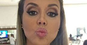 Renata Banhara surpreende ao mostrar antes e depois de infecção