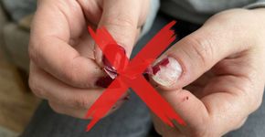Arrancar o esmalte em gel com as mãos pode levar parte da superfície da unha: os cuidados que tornam a remoção menos agressiva