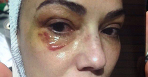 Luiza Brunet entrega vídeo de ex seminu como prova de agressão