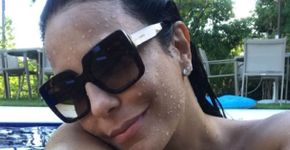 Ivete Sangalo revela que está com melasma