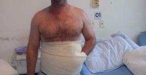 Catarinense tem a mão colocada dentro da própria barriga para evitar amputação