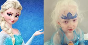 Como a princesa Elsa ajudou uma garotinha a aceitar seu albinismo