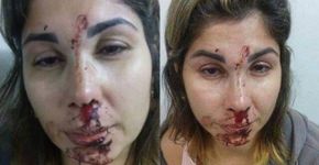 Sargento do Exército que agrediu esposa recebe apoio nas redes
