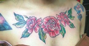 Jovem divulga fotos para alertar perigos da remoção de tatuagem