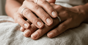 O que significa quando as unhas ficam com manchas brancas e quebram por qualquer bobeira