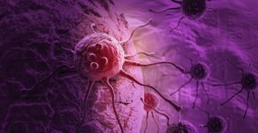 Foto: (iStock / vitanovski)