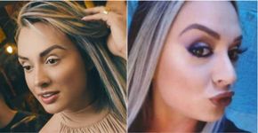 Juju Salimeni aplica botox e exibe resultado na web