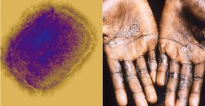 Foto: (Science Photo Library/CDC)