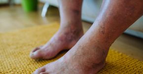 Foto: (iStock/Halfpoint)
