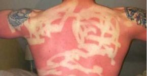 Galeria de fotos traz banhos de sol mal sucedidos