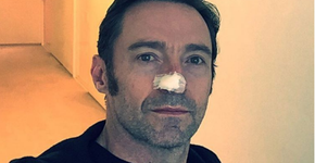 Hugh Jackman retira tumor do nariz e faz alerta nas redes sociais