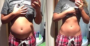 Blogueira mostra o que o estresse pode causar no corpo