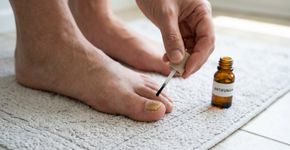 Como se livrar rapidamente da micose nas unhas dos pés?