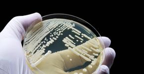 Foto: (iStock/TopMicrobialStock)