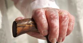 Pergunte ao Doutor: Alzheimer