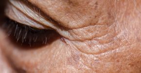 Foto: (pinglabel/istock)